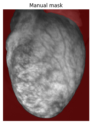 ../../_images/50403dba33ce687aad296f0f8ddf998b6f7bb3dbeb23c0e11a843652620a3905.png