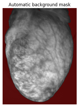 ../../_images/755f85e2902ef6f74a546779b12f0b1b5ff4e8986b97fc11346328183b3a27e3.png